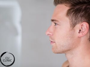 עיצוב הפרופיל להדגשת איזון בין האף, הסנטר והשפתיים