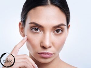 עיצוב לחיים להדגשת עצמות לחיים והוספת נפח טבעי