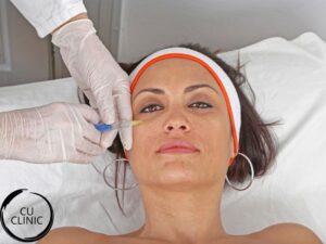 שקעים מתחת לעיניים לפני טיפול מילוי שקעי עיניים