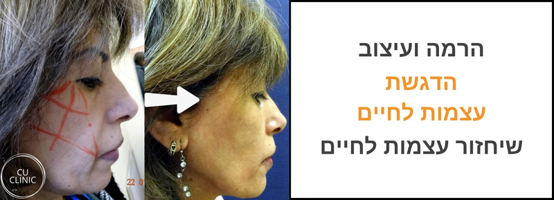 עיצוב לחיים לפני ואחרי למראה צעיר וטבעי