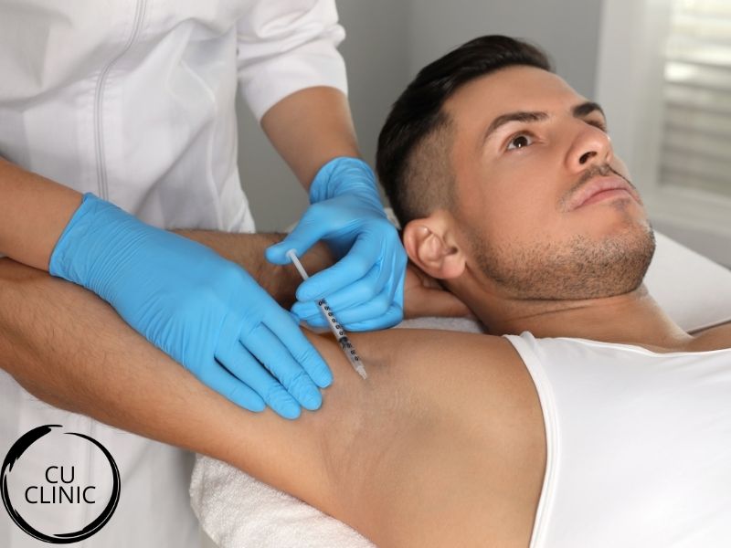 הזרקת בוטולינום טוקסין להזעת יתר בבית השחי