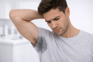 הזעת יתר בבית השחי – מה חשוב לדעת לפני טיפול