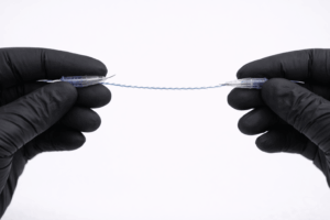 חוטים נספגים – מה חשוב לדעת לפני טיפול