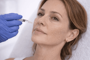 מזותרפיה – מה חשוב לדעת לפני טיפול