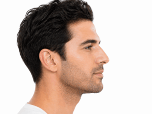 עיצוב אף לגברים ללא ניתוח מראה טבעי