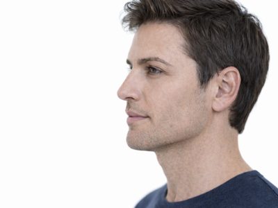 תיקון אף ללא ניתוח באמצעות חומצה היאלורונית