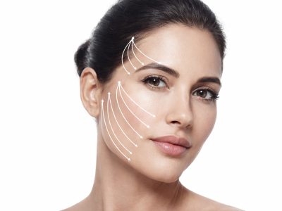 חוטים נספגים להרמת פנים ומתיחה ללא ניתוח